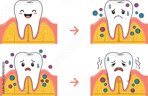 Tooth Decay Progression Illustration with Healthy Tooth to Infected Stages Showing Bacteria Growth and Dental Disease Medical Vector Diagram Set