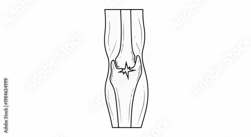 Stylized anatomical illustration of a knee joint with a starburst pain symbol