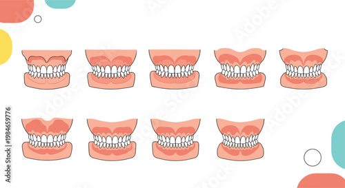 Dental chart displaying various types of malocclusion and tooth alignment issues in human jaws for medical study.
