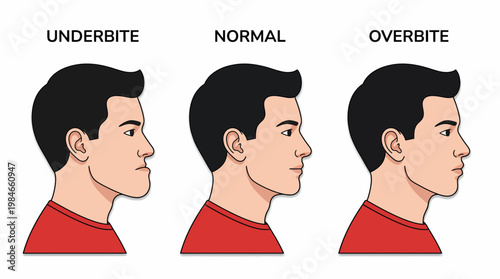 side profile illustration of a male corporate office manager showing comparisons between underbite normal and overbite jaw alignment, concept for orthodontic surgery, dental hygiene and care