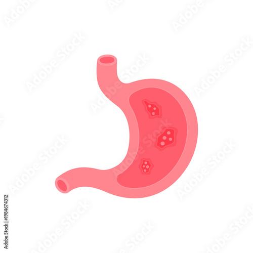 stomach  with virus or bacteria inside Illustration 