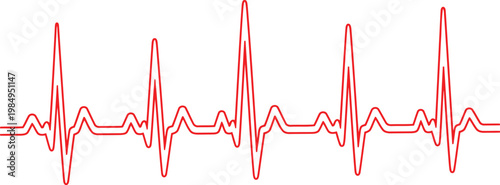 Electrocardiogram showing irregular heart rhythm patterns with multiple waveforms Vector