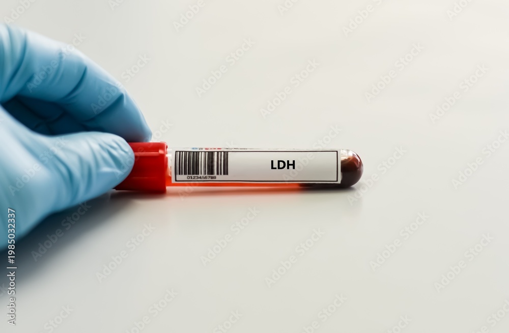 Obraz premium Blood sample tube for LDH test analysis.