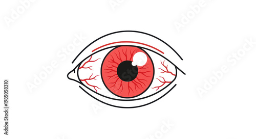 Irritated Red Eye with Bloodshot Veins and White Spot - Ophthalmology Concept