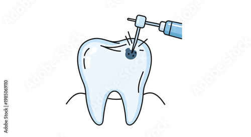 Detailed close-up vector graphic showcasing a stylized, healthy white tooth undergoing dental cavity drilling procedure with a high-speed handpiece and water spray for oral hygiene and treat
