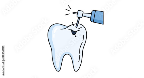 Cartoonish, simplified dental drill treating a human molar with a large cavity, showcasing a medical procedure for tooth decay and oral hygiene in a clean, white background.