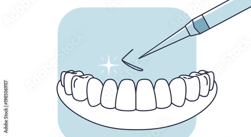 Close-up minimalist line art vector of a dental scaler gently polishing a sparkling white tooth within a perfect set of gums for a bright smile.