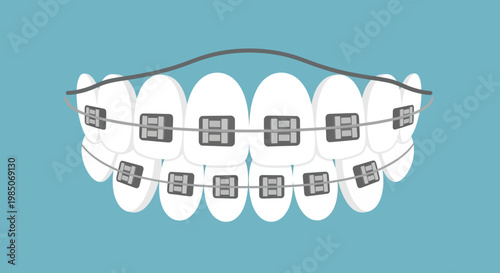 Close-up of straightened teeth undergoing orthodontic treatment with metallic braces, showcasing dental alignment correction and oral hygiene, rendered in a clean, vector style.