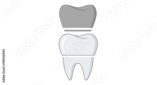 Simplified graphic representation of a tooth undergoing a dental procedure, showing a crown on the upper portion, symbolizing oral care and dental health.
