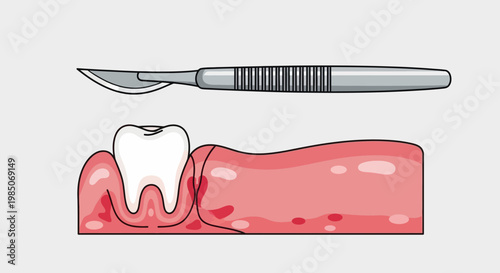 Medical dental scalpel poised above inflamed, swollen gum tissue showing inflammation and decay around a healthy tooth, abstract cartoon style.