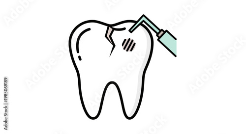 Graphic depiction of a cracked tooth undergoing dental repair using a professional dentist's drill, symbolizing oral hygiene and restorative dentistry treatment.