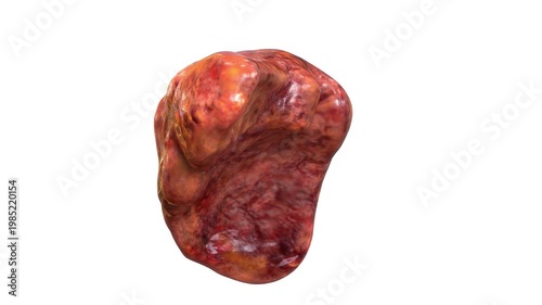 Human Internal Digestive Organ Liver with Cirrhosis Anatomy Animation Concept