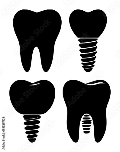 Dental implant tooth set with solid black icon design featuring dentistry, stomatology, oral care with health and medicine