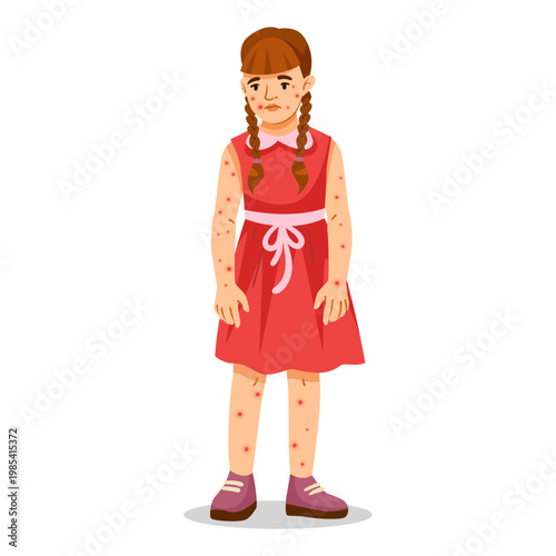Young sick child with skin rash in flat art style on white background, concept of disease and healthcare. Vector illustration