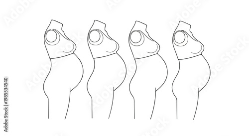 Set of 4 Pregnancy Stages Vector Illustration