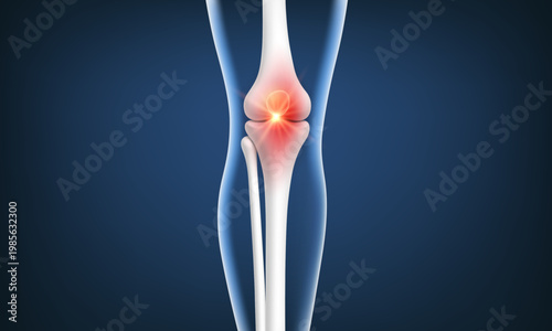 3D visualization of knee pain. Leg bones with red inflammation in the knee joint area. Biological and medical concept. Vector illustration