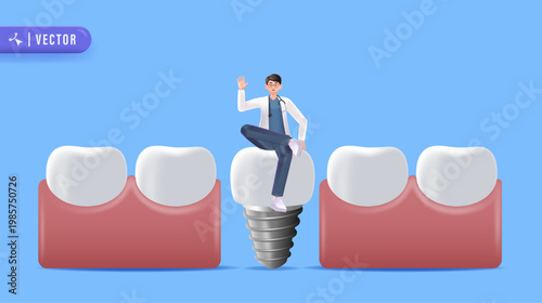 Dental Implant Illustration with Dentist Character Sitting on Tooth, Modern Dentistry Concept, Oral Health Care, and Clean Medical Design