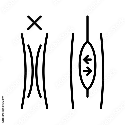 Balloon angioplasty icon. Healthcare and cardiology line symbol. Black and white.