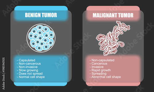 Vector illustration of malignant and benign tumors in body tissues. Difference between malignant and benign tumors, Spread of cancer cells. Glass effect design for education, posters, clinics,