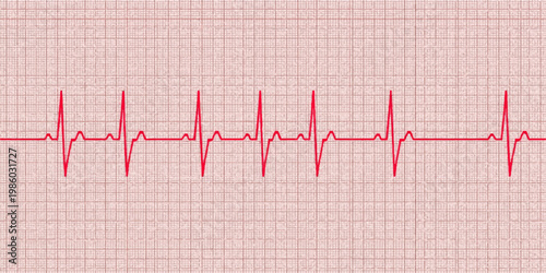 A medical graphic of a healthy heartbeat rhythm shows a red electrocardiogram line on a cardiogram pulse rate monitor chart for cardiology tests in a hospital healthcare setting