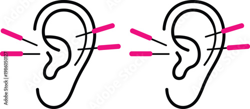 Diagram illustrating directions for cleaning the outer ear area with cotton swabs