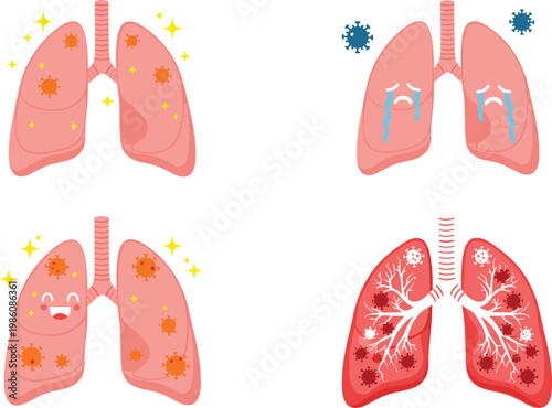 Lung Health and Disease Illustration Set Showing Clean Lungs Infected Lungs and Respiratory Problems for Medical Healthcare Awareness and Anatomy Education Design Collection