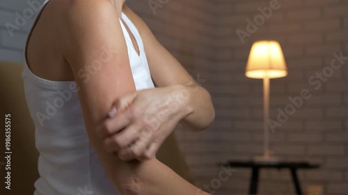 Woman with allergy itch scratching her irritated arm skin. Woman scratching her itchy arm due to an allergic reaction or dermatitis, showing redness and skin irritation from intense scratching