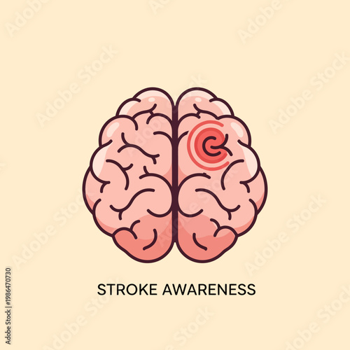 Medical vector illustration of a human brain showing a red concentric circle icon on the right hemisphere to indicate a stroke location, with Stroke Awareness text below.