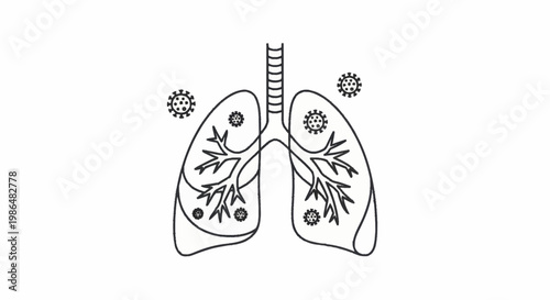 Human Lungs Infected by Viruses Representing Respiratory Illness.