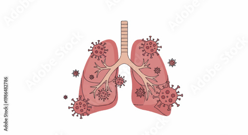 Human Lungs Infected with Coronavirus Disease Illustration.