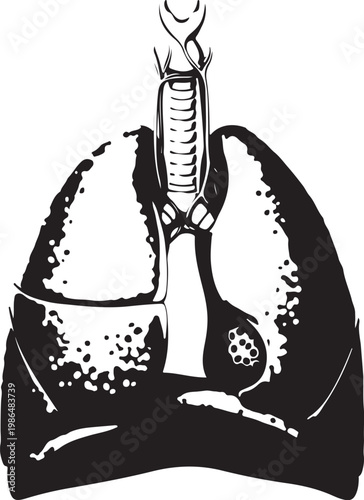 Anatomical illustration of human lungs and trachea