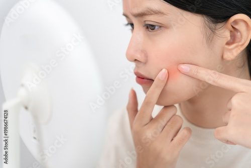Woman worried about face Dermatology, rosacea dermatitis, allergic steroids, sensitive skin, red face from sunburn, acne, dry skin, large pores ,rash face, dull, freckles, wrinkle, skin problem,