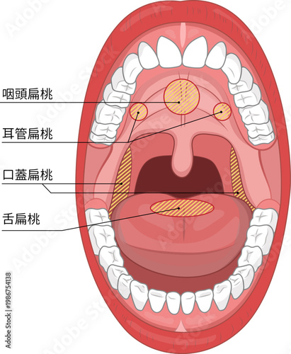 成人が口を大きく開けた口腔内と口の中の扁桃を分かりやすく表したイラスト