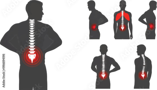 Set of Male Silhouettes with Highlights of Back Pain and Spine Inflammation
