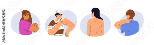 Rash, inflammation, irritation and redness on skin. Itch, allergy, red marks from insect bites. Dermatology problems, alergic reaction on body. Flat vector illustration isolated on white background