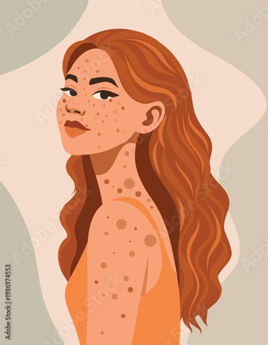 Natural female beauty. Vector portrait of a woman with red hair, freckles, and moles. Perfect for campaigns celebrating diversity, self-acceptance, skincare, and body positivity