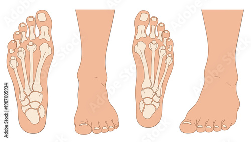 Anatomical illustration showing the bone structure and surface anatomy of the human foot from multiple angles including top and side views.