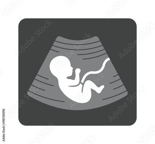 Vector illustration of a fetus in an ultrasound scan, ideal for medical apps, prenatal care resources, and pregnancy health websites. Simple, clear design.