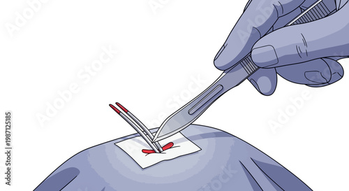 Surgical Procedure Illustration Featuring a Surgeon's Hand with Forceps and Scalpel Performing an Incision on a Patient During a Medical Operation Vector Graphic