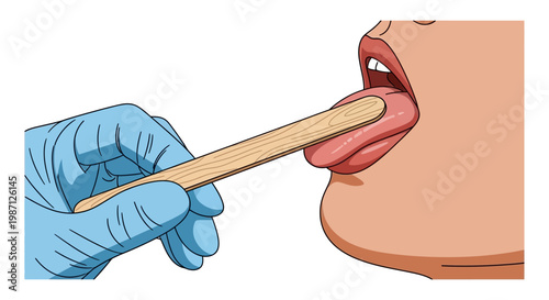 Vector illustration Medical professional examining a patient's throat with a tongue depressor for oral cavity diagnosis and healthcare check-up
