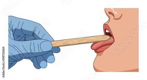 Doctor examining throat with tongue depressor, vector illustration of medical checkup and health care, conceptual medical examination for sore throat