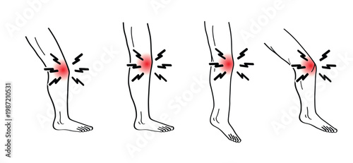 Knee injury. Structure of the knee joints. Human leg. Person with a red knee. Painful, injury, ache, health problems. Knee joint pain, arthritis and tendon problems, health care.