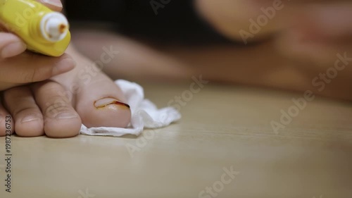 Close-up of a child applying antiseptic to a minor finger wound with tissue on a table. The image reflects first aid, wound care, hygiene, safety, and basic home medical treatment.