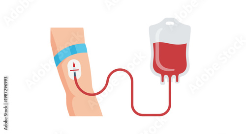 Vital Blood Donation and Transfusion Process for Healthcare and Life-Saving Medical Procedures, Illustrating Arm and Blood Bag Connection