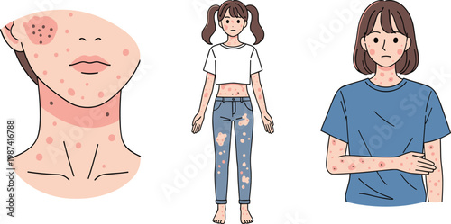 Skin Allergy and Rash Symptoms Set with Body Irritation Red Spots and Dermatology Condition for Healthcare Awareness Flat Vector Illustration