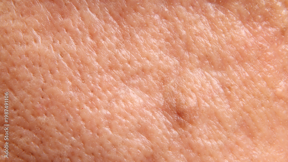 Fototapeta premium Macro closeup of human skin showing a raised mole or skin with visible pores uneven texture