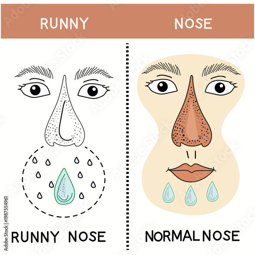 Nasal condition comparison showing runny nose and healthy state