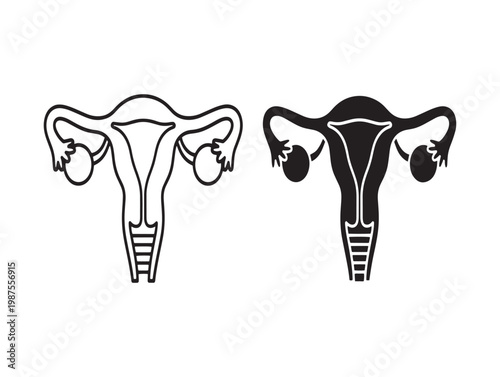 Detailed anatomical illustration of the female reproductive system uterus ovaries and fallopian tubes