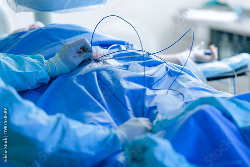 Fotografía Cardiac catheterization operating scene with surgeons manipulating catheters and