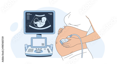 Pregnant Woman Undergoing Ultrasound Scan, Baby Image on Screen, Medical Technology